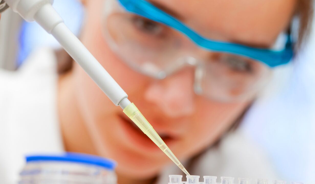 L'analyse en laboratoire de l'urine une méthode de diagnostic de la prostatite. 